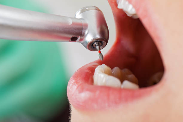Best Walk-In Emergency Dentist in Parole, MD